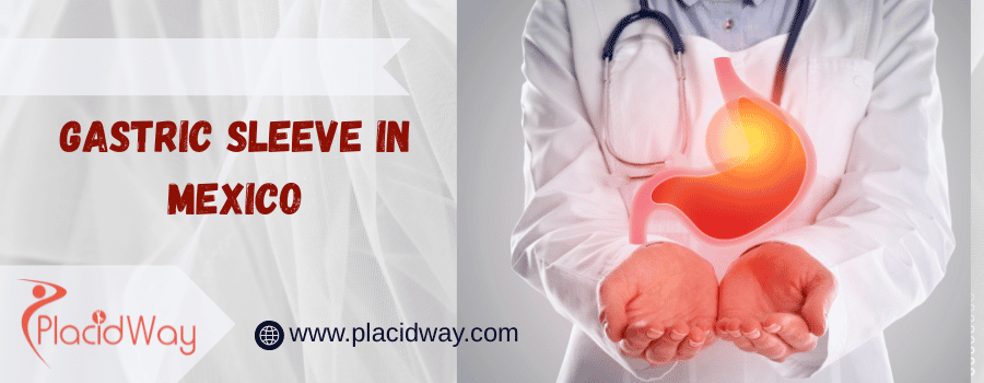 gastric sleeve in Mexico