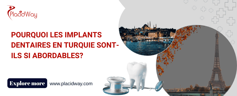 Pourquoi Les Implants Dentaires en Turquie Sont-ils si Abordables?