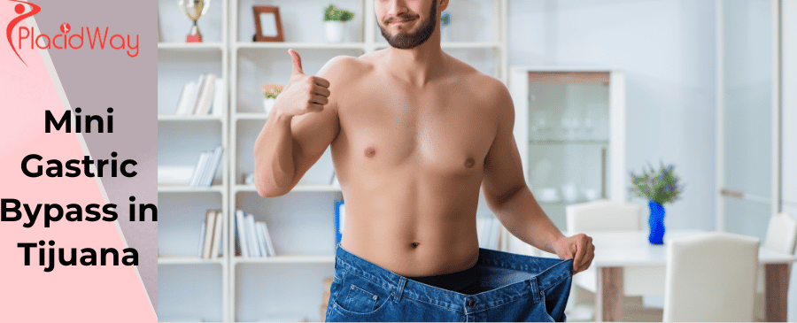 Mini Bypass Gástrico en Tijuana