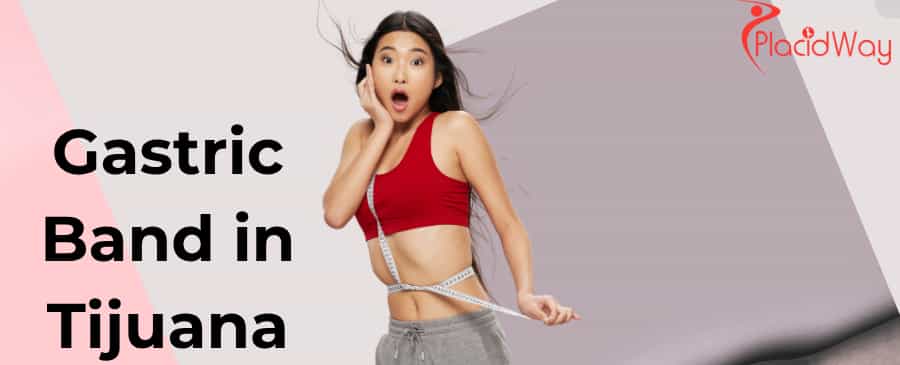 Banda Gástrica en Tijuana