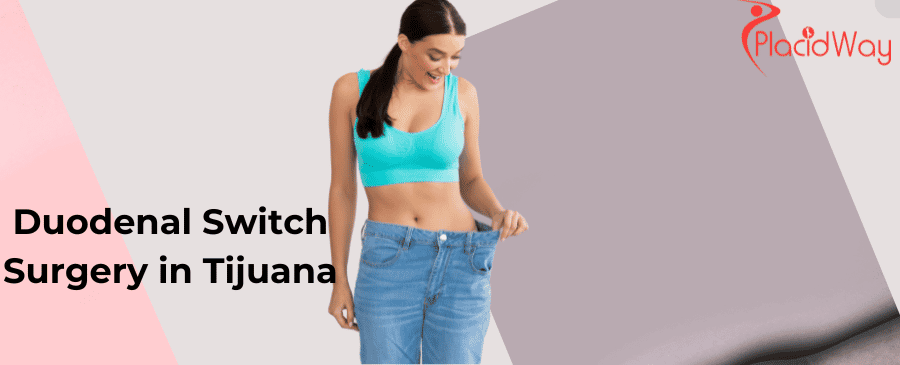 Cirugía de cruce duodenal Tijuana