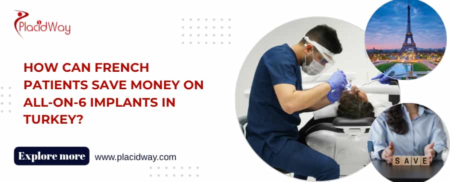 How Can French Patients Save Money on All-on-6 Implants in Turkey?