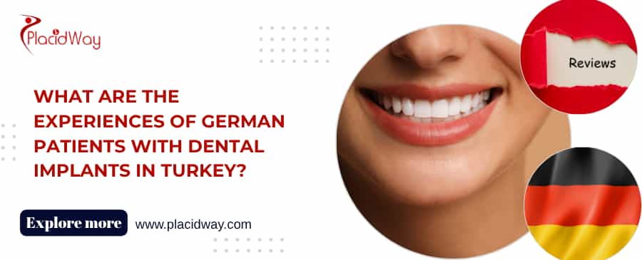 What Are the Experiences of German Patients with Dental Implants in Turkey?