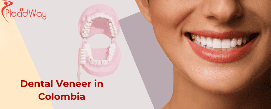 Dental Veneer in Colombia