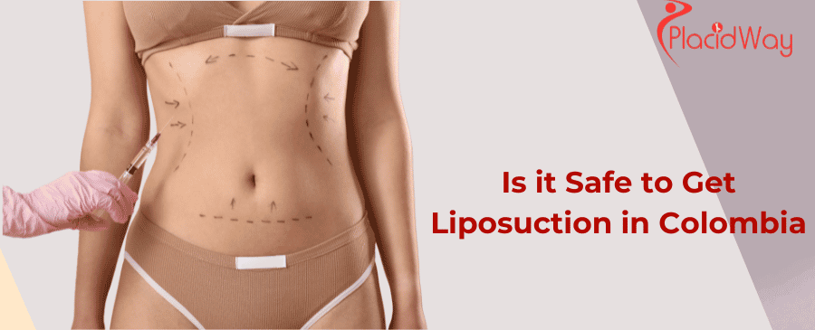 Is it Safe to Get Liposuction in Colombia