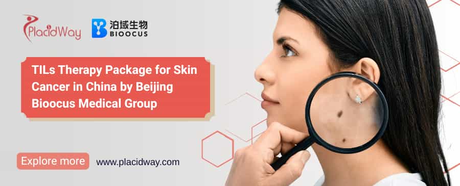 การบำบัดมะเร็งผิวหนังด้วย TIL ในประเทศจีน