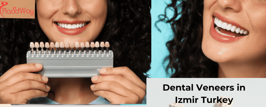 dental veneers in izmir turkey