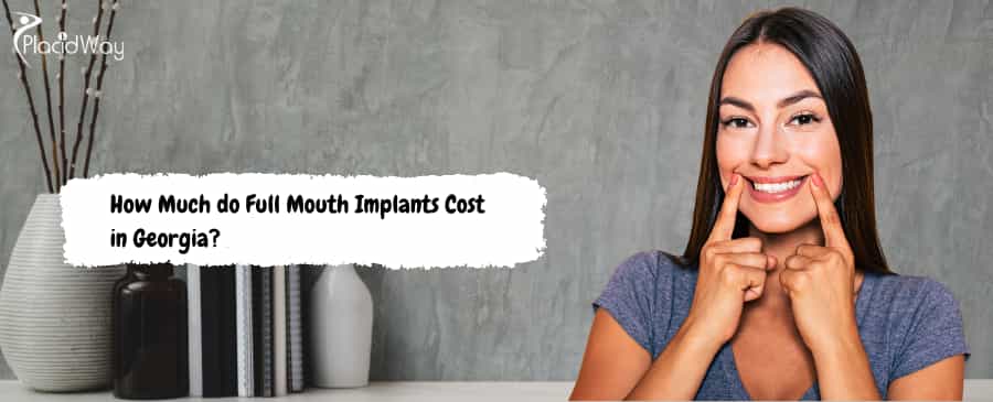 Full Mouth Implants Cost in Georgia