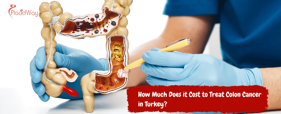 Colon Cancer in Turkey