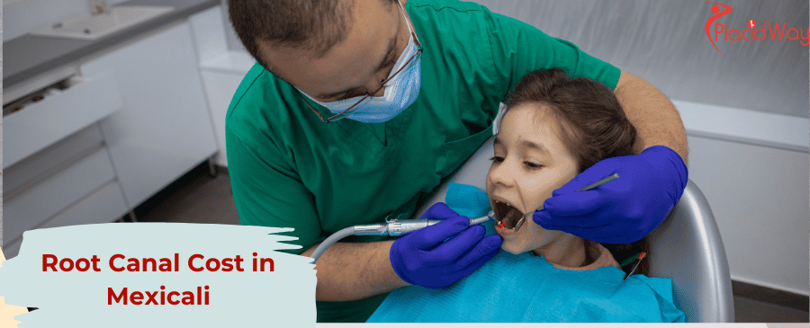 Costo de la endodoncia en Mexicali