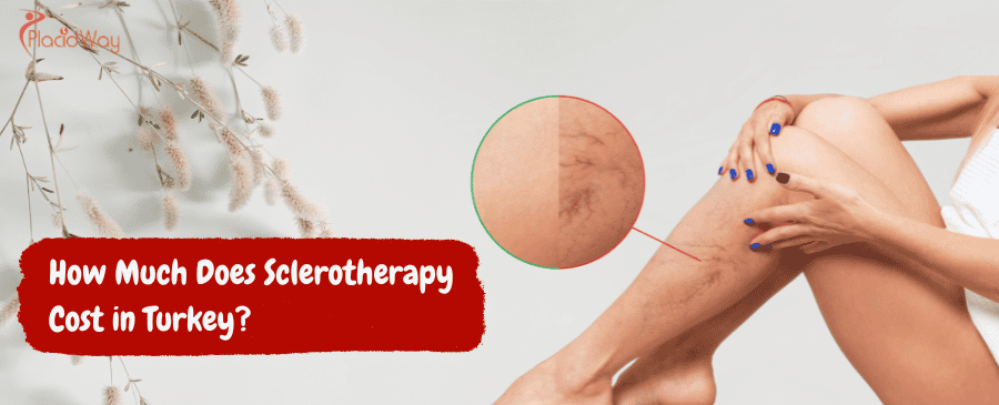 Sclerotherapy Cost in Turkey