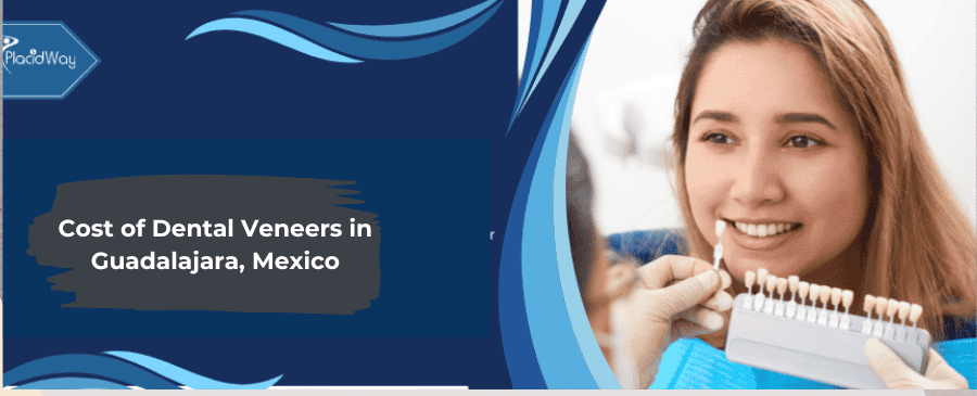Cost of Dental Veneers in Guadalajara, Mexico