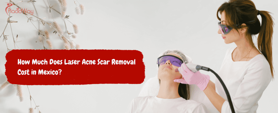Laser Acne Scar Removal Cost in Mexico