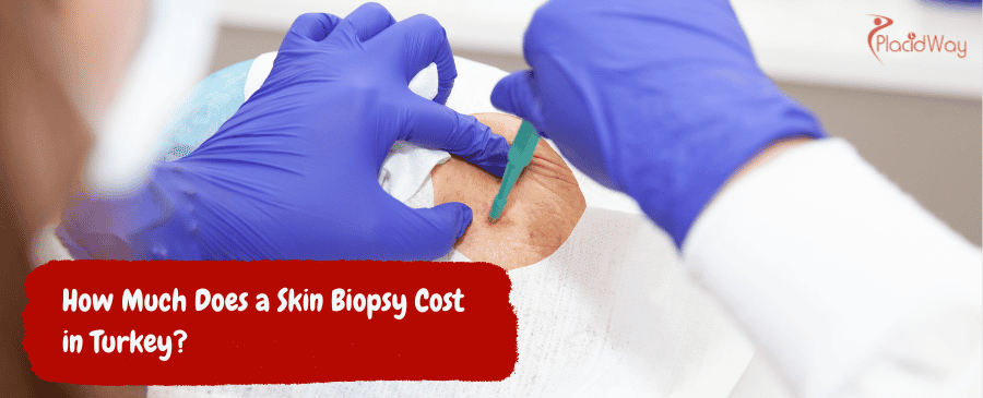 Skin Biopsy Cost in Turkey