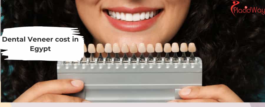 Dental veneer  in Egypt