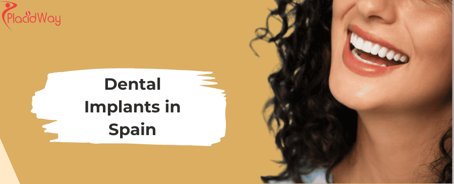 Dental Implants in spain