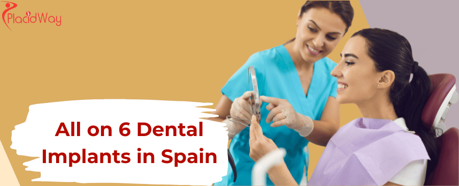 All on 6 Dental Implants in Spain