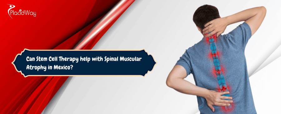 stem cell therspy for Spinal Muscular Atrophy in Mexico