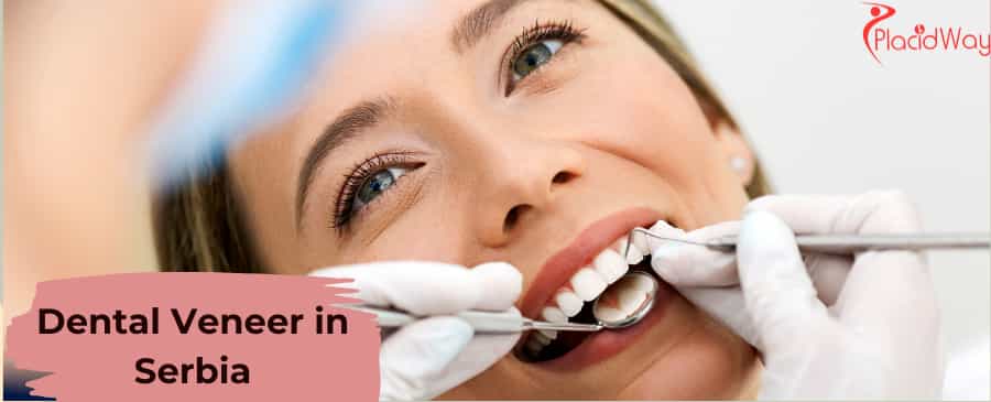 Dental Veneer in Serbia