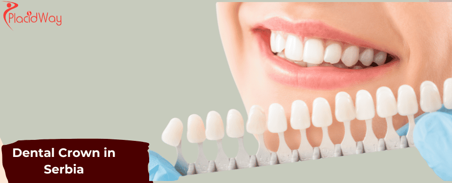 Dental Crown in Serbia