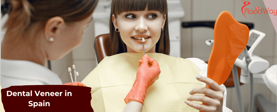 Dental Veneer in Spain