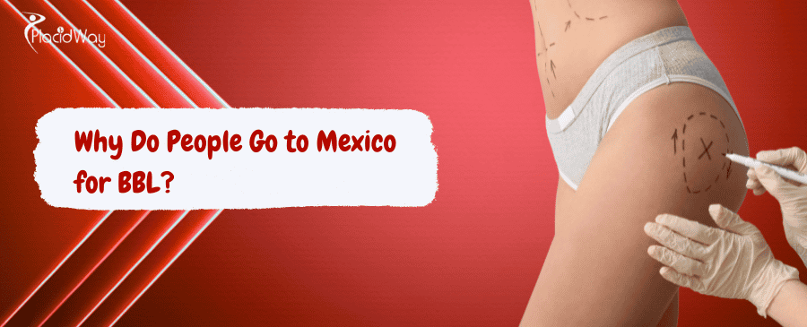 Brazilian Butt Lift in Mexico