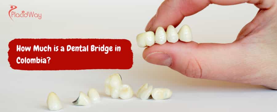 Dental Bridge in Colombia