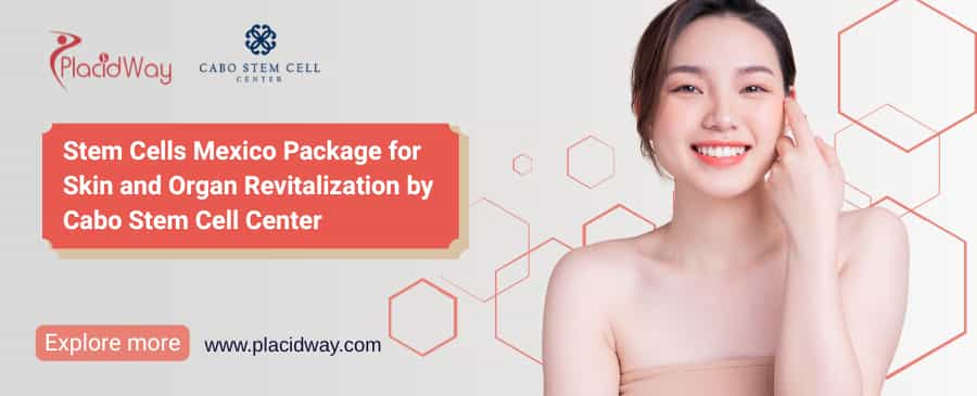 Stem Cells Mexico Package for Skin and Organ Revitalization by Cabo Stem Cell Center