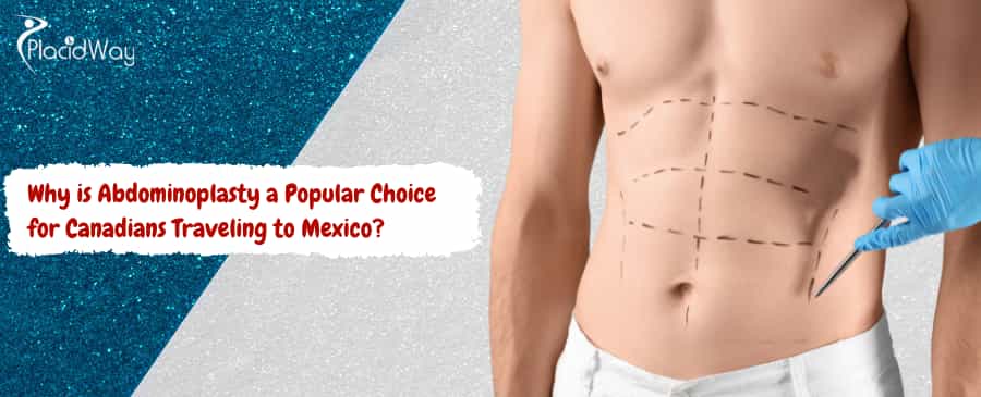 Abdominoplasty a Popular Choice for Canadians Traveling to Mexico