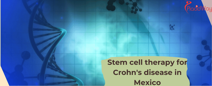 stem cell therapy for Crohn in Mexico
