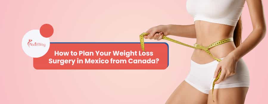 How to Plan Your Weight Loss Surgery in Mexico from Canada?