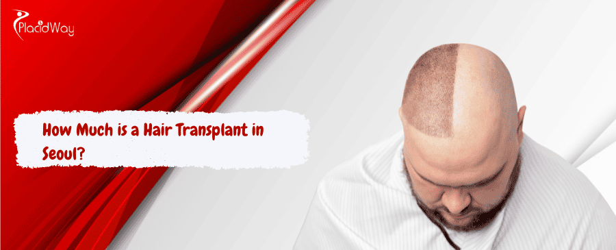 Hair Transplant in Seoul