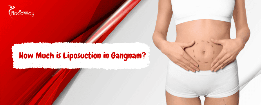 Liposuction in Gangnam