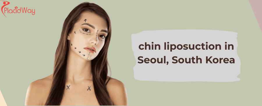 chin liposuction in Seoul, South Korea