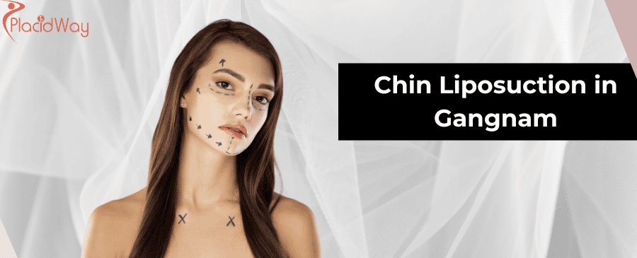 Chin Liposuction in Gangnam