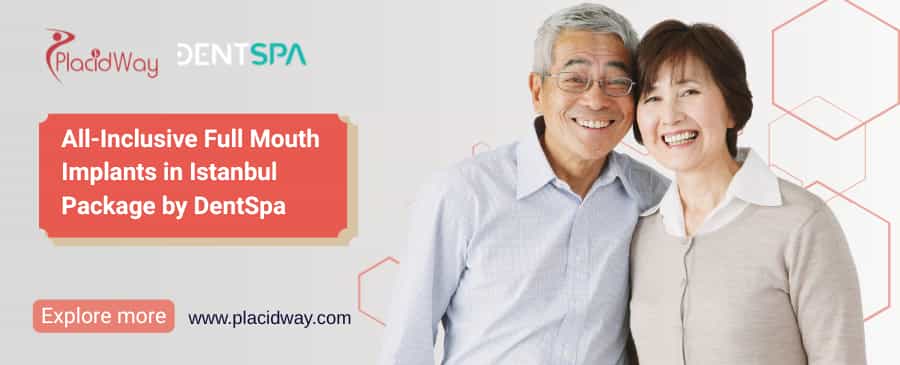 Implantes bucales completos en Estambul con DentSpa