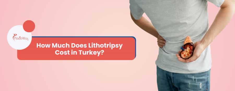 How Much Does Lithotripsy Cost in Turkey?