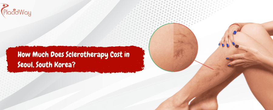 Sclerotherapy Cost in Seoul, South Korea