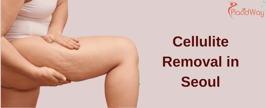 Cellulite Removal in Seoul
