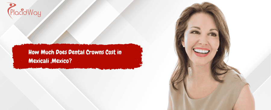 Dental Crowns Cost in Mexicali ,Mexico