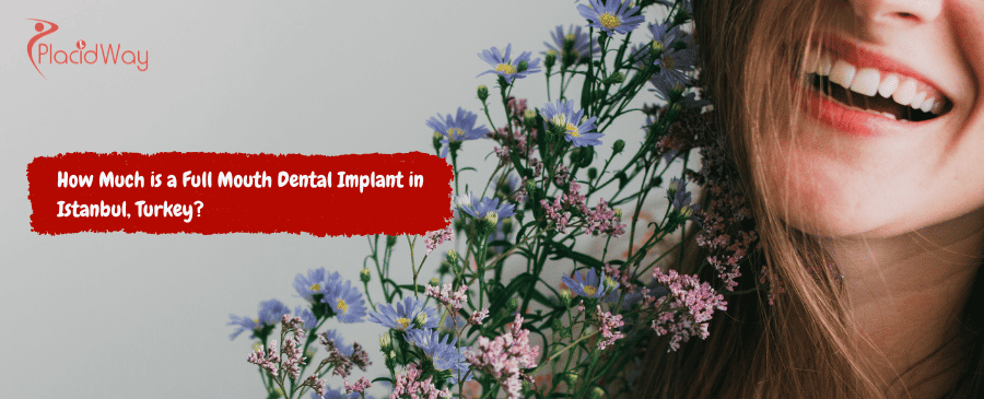 Full Mmouth Dental Implant in Istanbul, Turkey