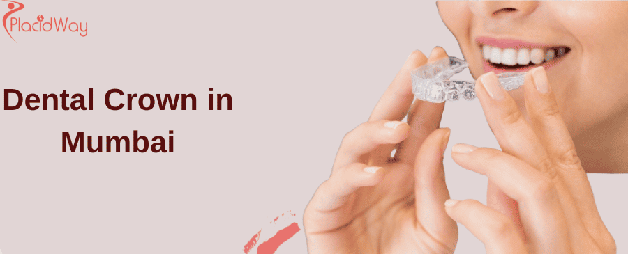 dental crown in Mumbai