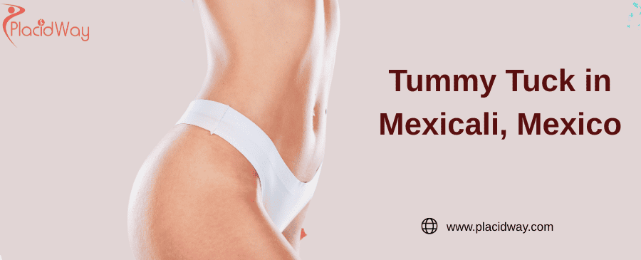 Tummy Tuck in Mexicali, Mexico