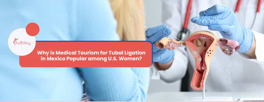 Why is Medical Tourism for Tubal Ligation in Mexico Popular among U.S. Women?