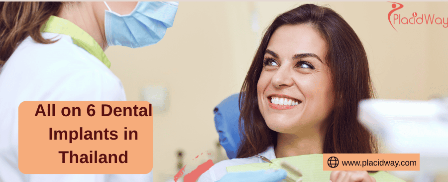 All on 6 Dental Implants in Thailand