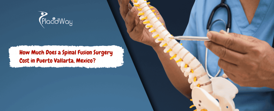 Spinal Fusion Surgery Cost in Puerto Vallarta, Mexico