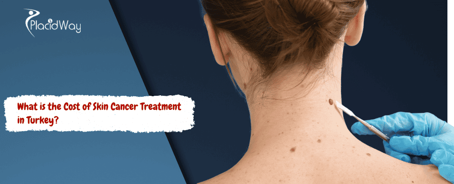 Skin Cancer Treatment in Turkey