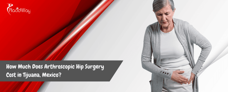 Arthroscopic Hip Surgery Cost in Tijuana, Mexico