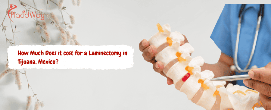 Laminectomy in Tijuana, Mexico