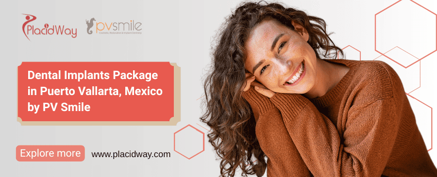 Puerto Vallarta Dental Implants PV Smile Offer